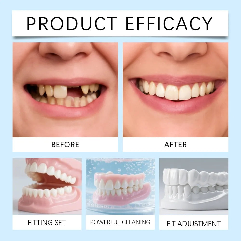 Prothèse Dentaire Complète Amovible en Silicone – Dentier Haut et Bas, Aspect Naturel & Confort Souple