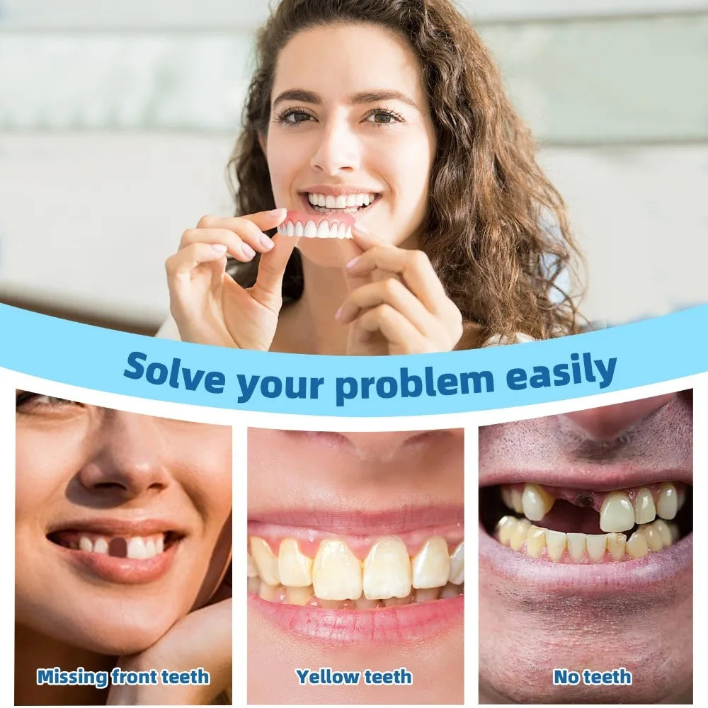 Prothèse Dentaire Complète Amovible en Silicone – Dentier Haut et Bas, Aspect Naturel & Confort Souple