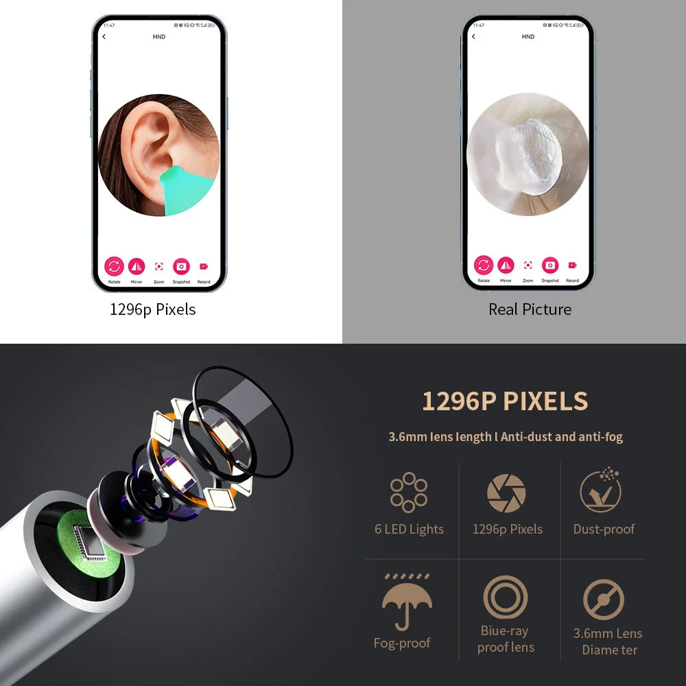 Cure-Oreille Intelligent HD avec Caméra WiFi