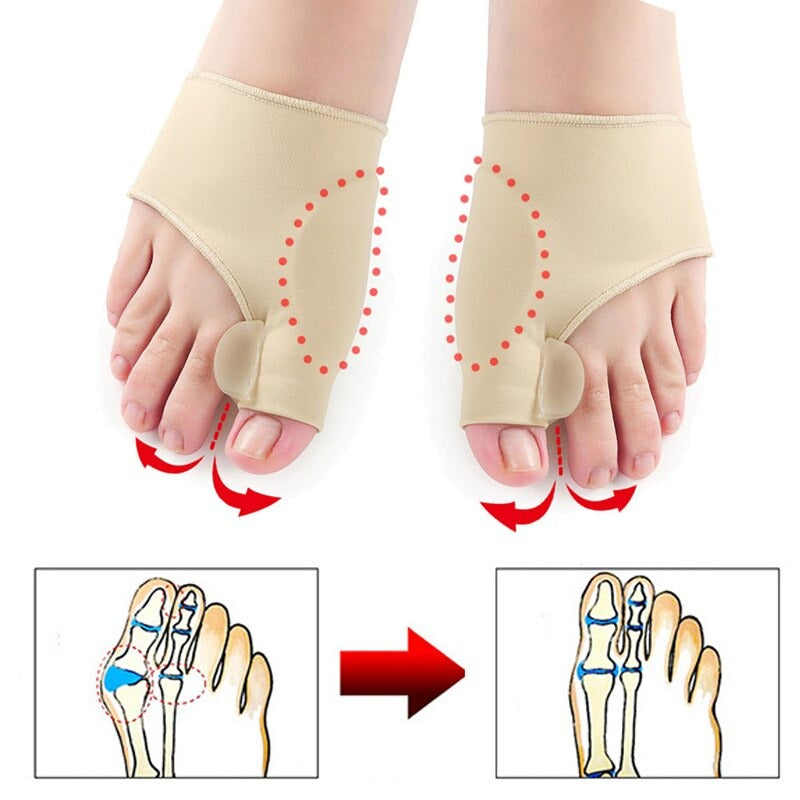 Correcteur orthopédique pour Hallux Valgus (Oignon)